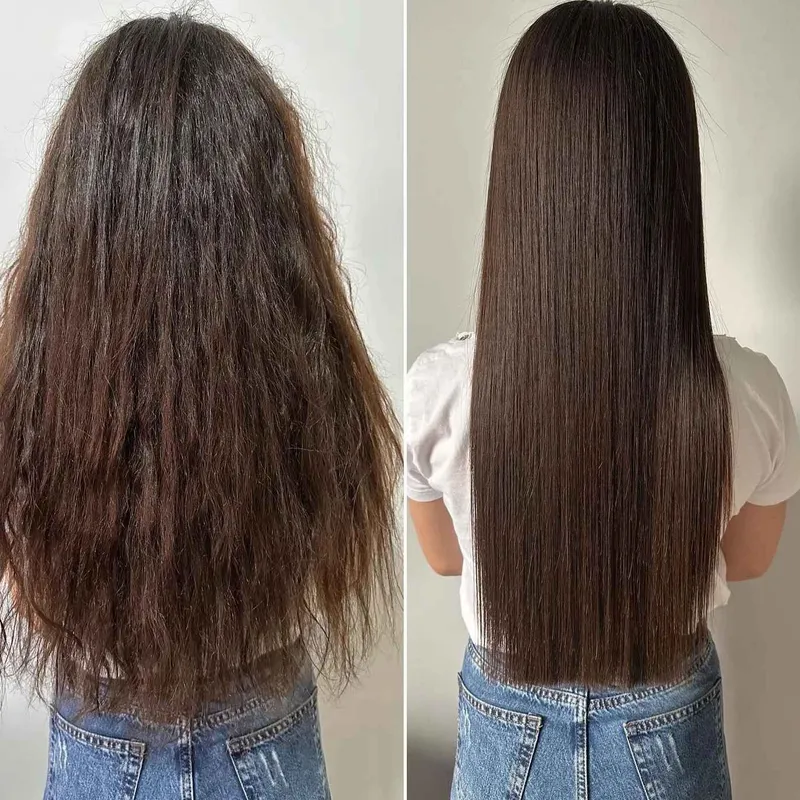 پروتئین تراپی