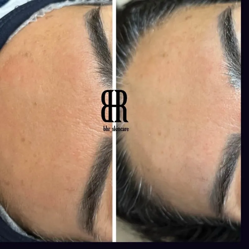 از بین بردن سلولهای مرده پوست آبرسانی تخصصی