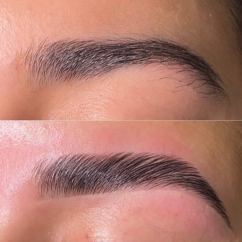 لیفت ابرو روسی