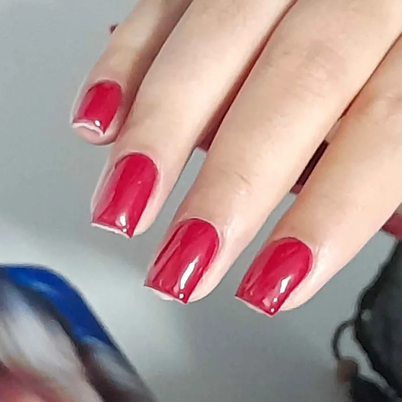 ترمیم با سافت ژل