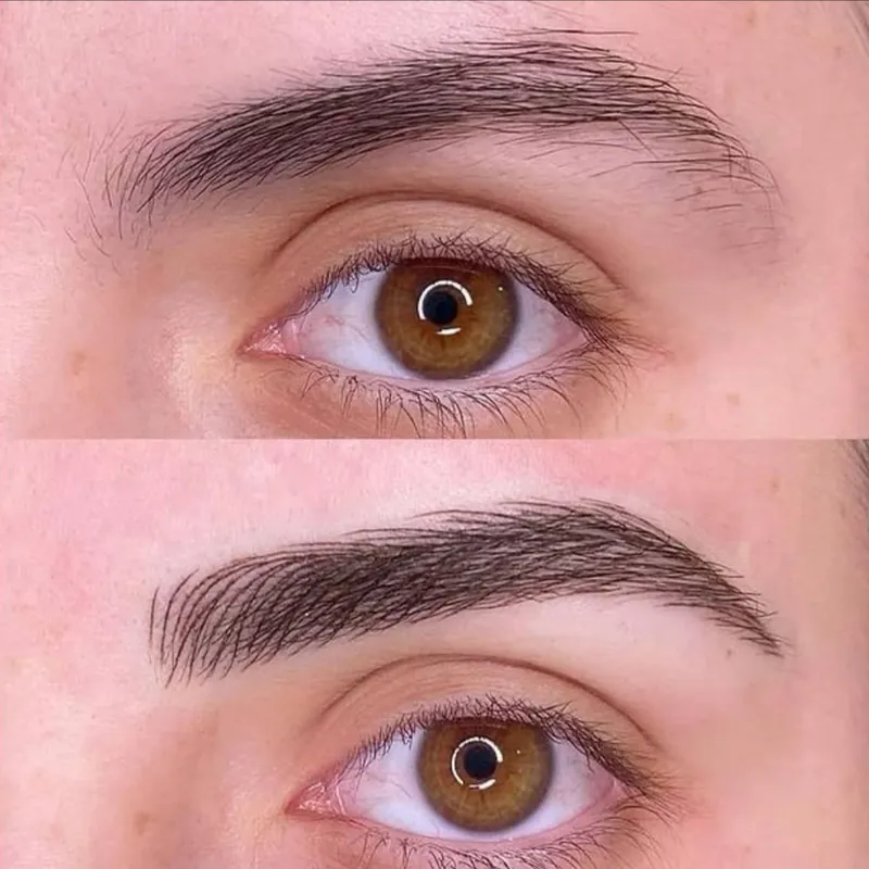 میکروبلیدینگ ابرو