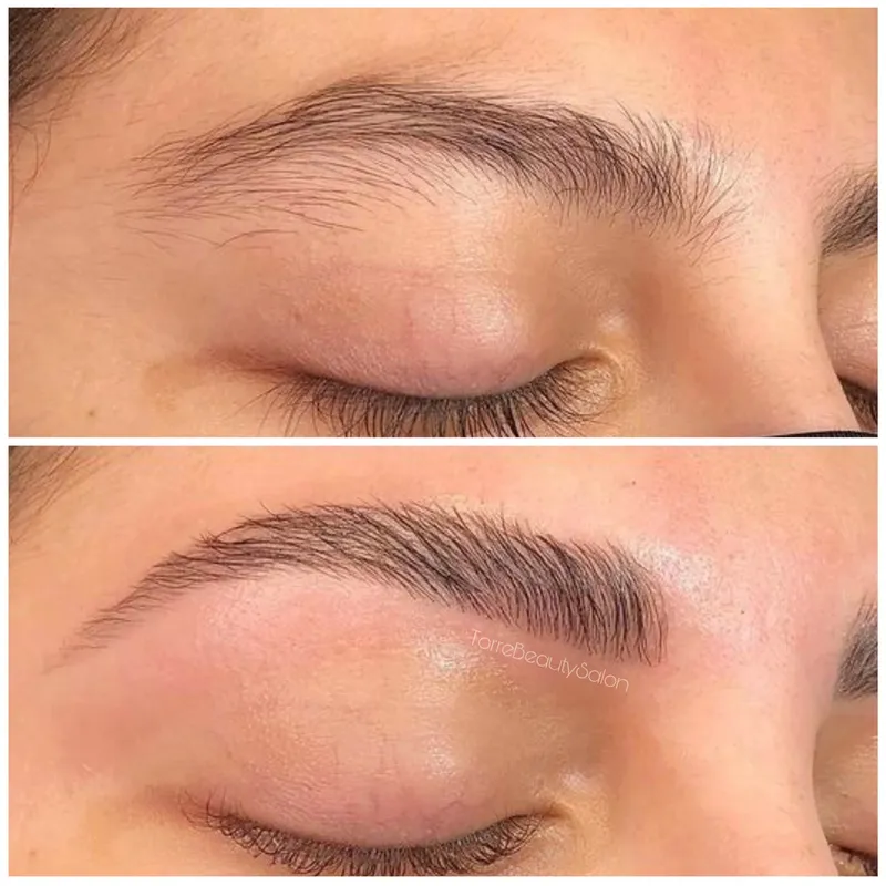 لیفت و تقویت ابرو