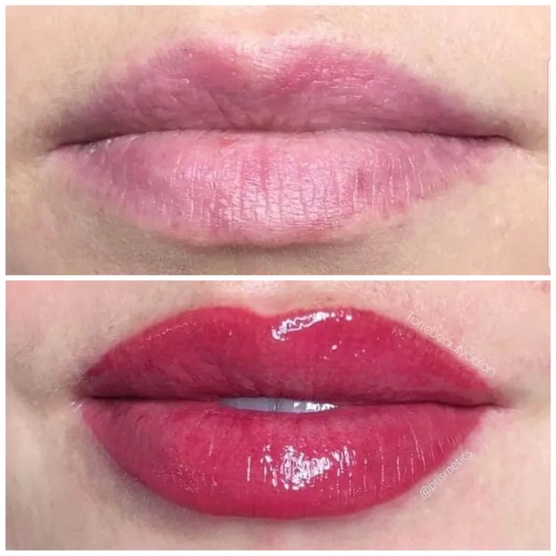 میکروپیگمنتیشن لب