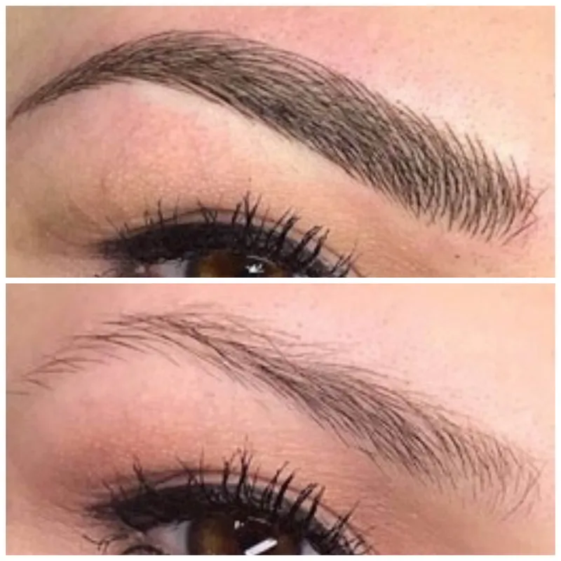 میکروبلیدینگ