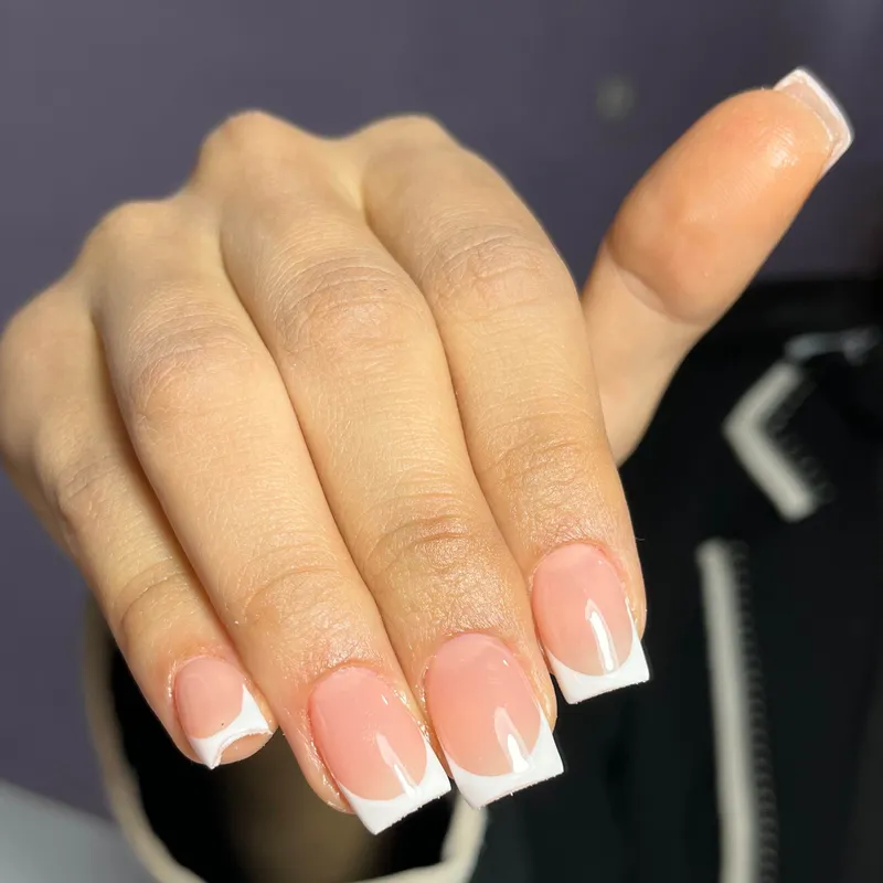 کاشت نچرال با دیزاین فرنچ