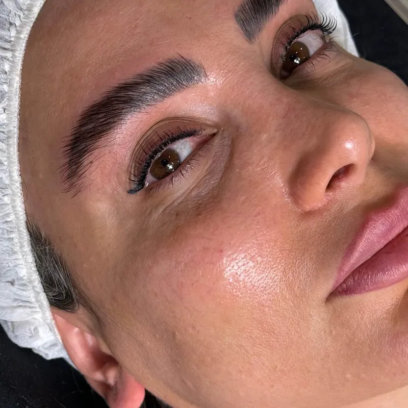 لیفت ابرو و مژه