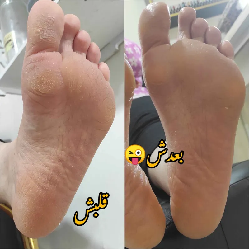 پدیکور کفسابی