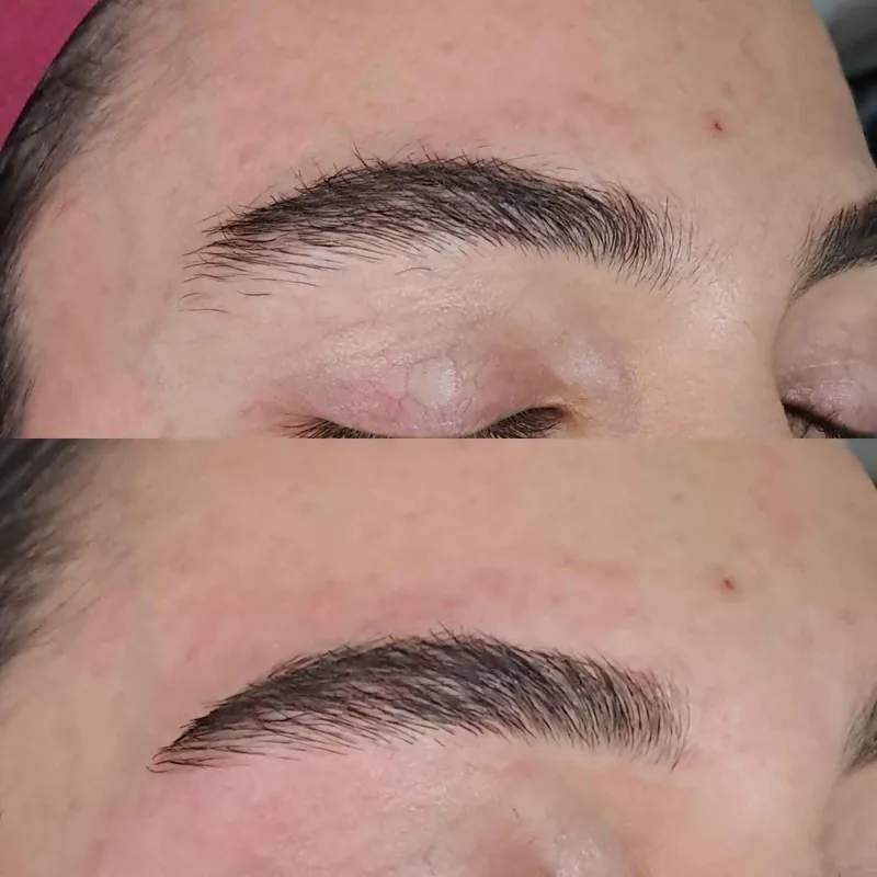 برداشتن تخصصی ابرو 