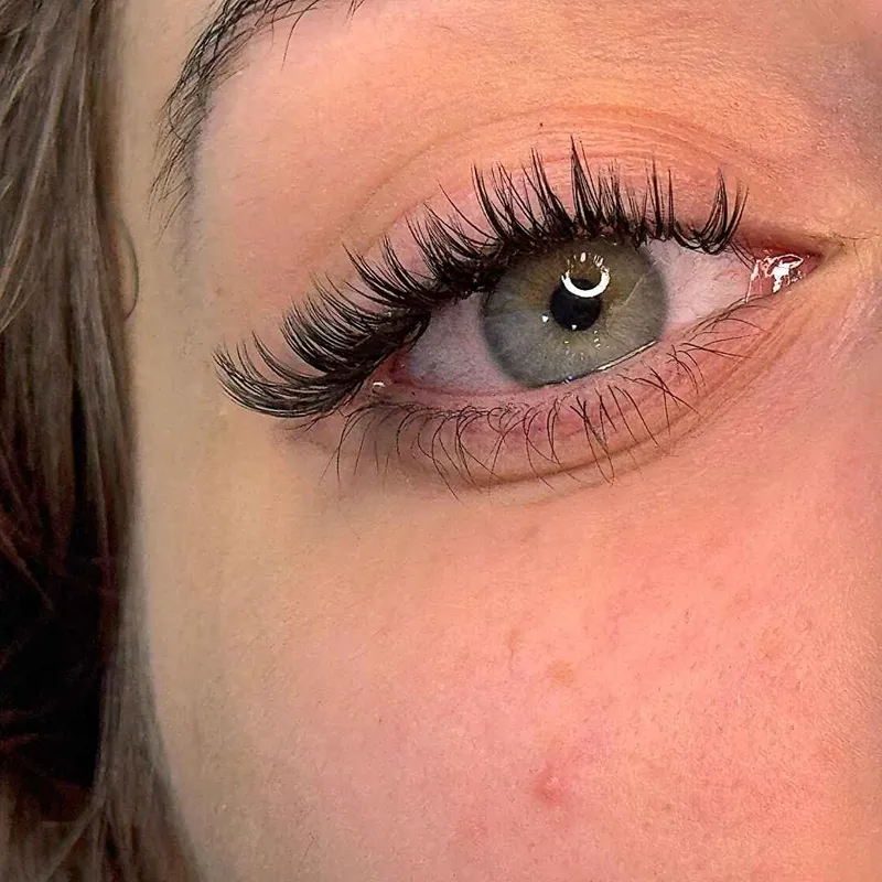 کاشت مژه کایلی