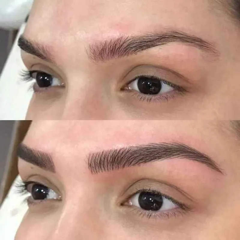 میکروبلیدینگ