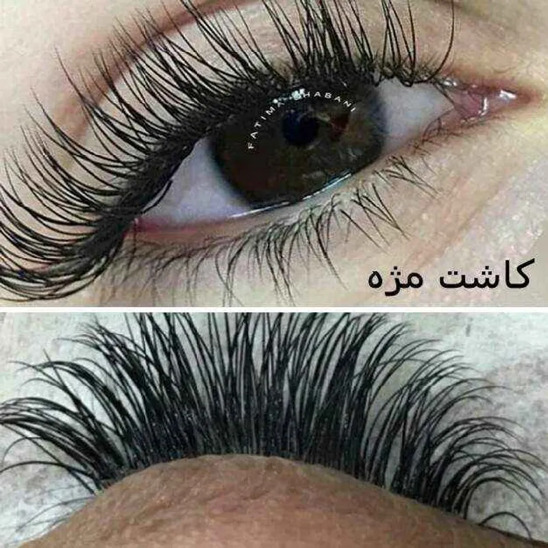 کاشت کلاسیک 