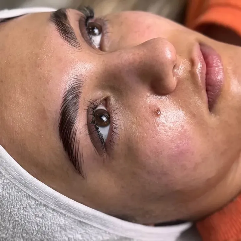 پاکسازی پوست