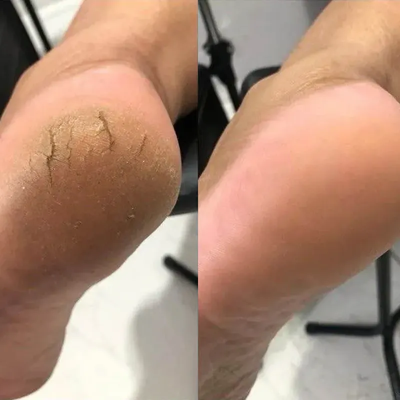 پدیکور حرفه ای برای داهای سالم و زیبا