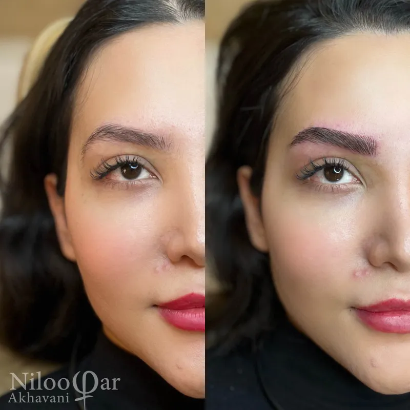 فيبروز ابرو