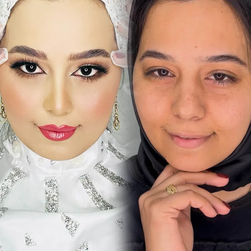پوست ضداب
