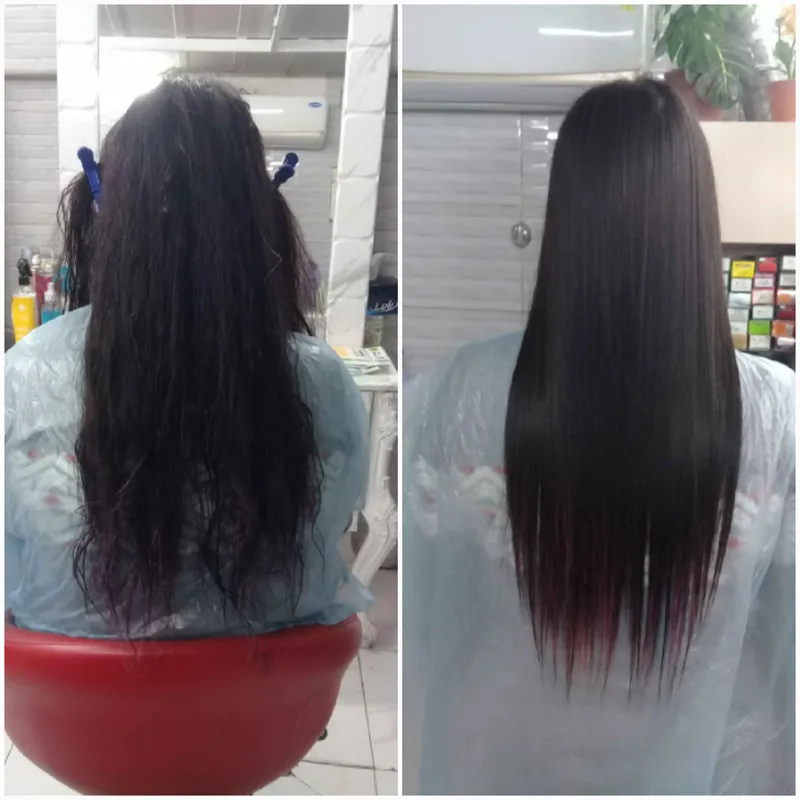 پروتئین تراپی