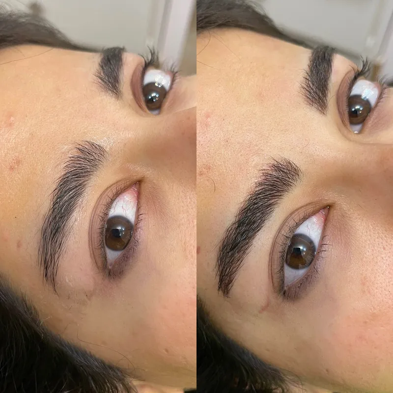 فیبروز ابرو