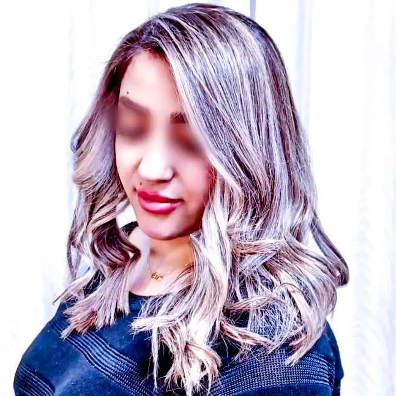 ترمیم لایت با فویل