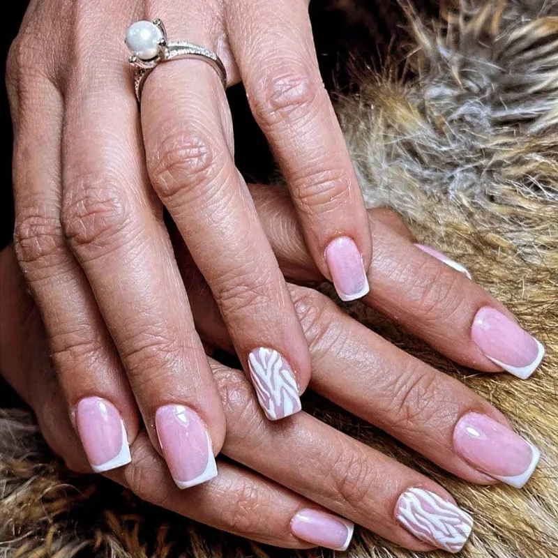 کاشت پلی ژل جذاب