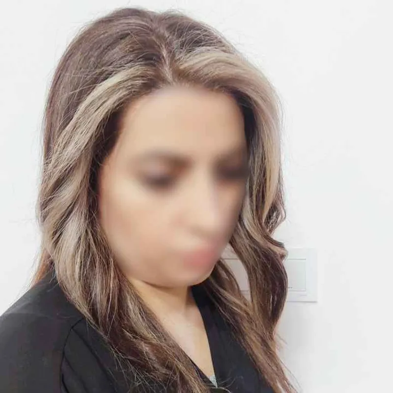 هد لایت تکنیک اقتصادی