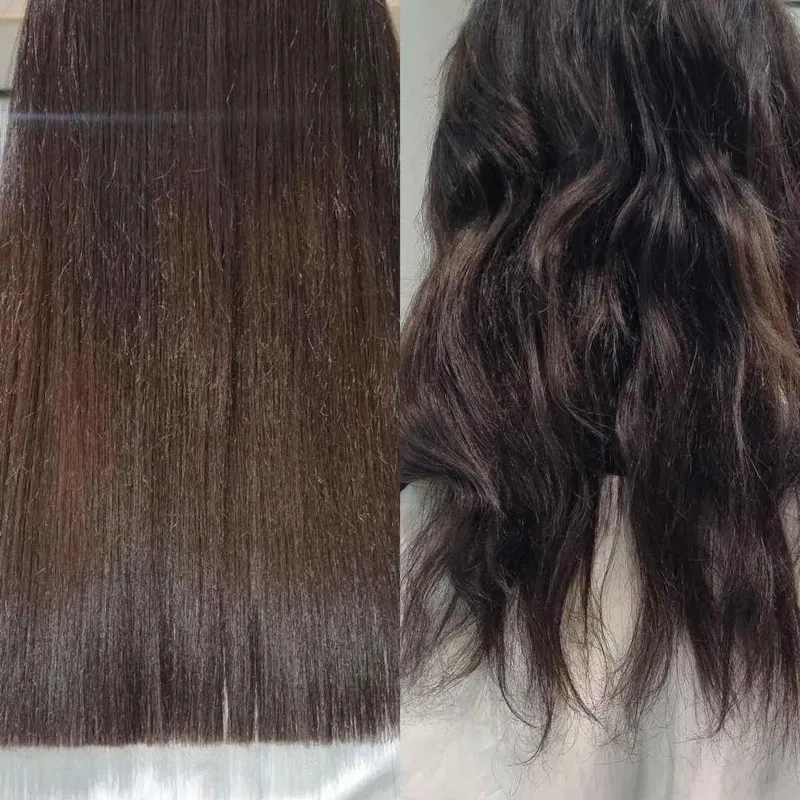 کات لیزری و موخوره تراپی 