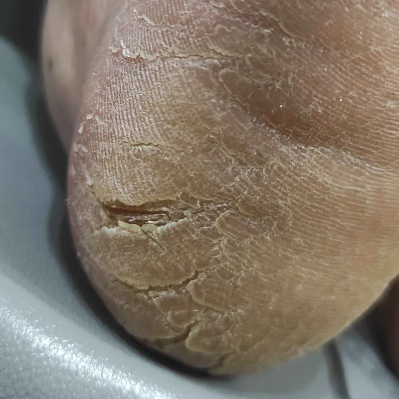 پدیکور درمانی 