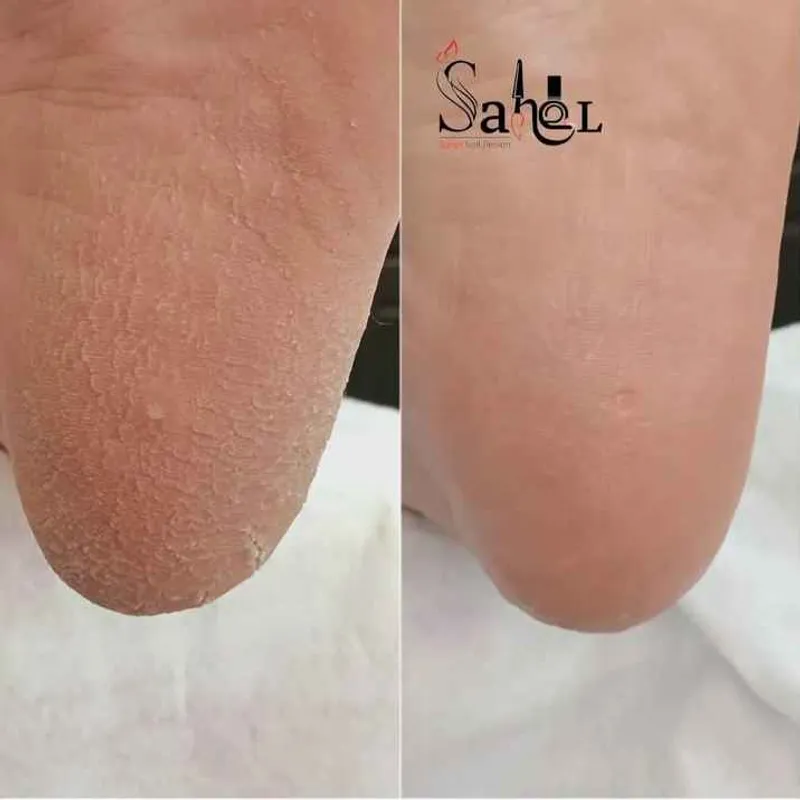 پدیکور کفسابی پا