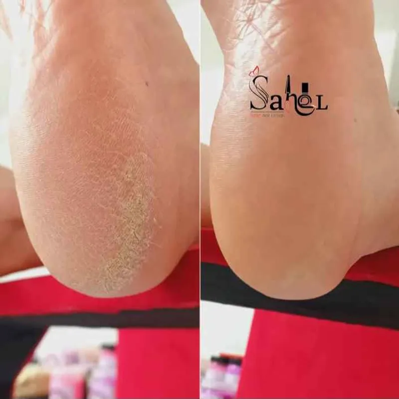 پدیکور کفسابی پا