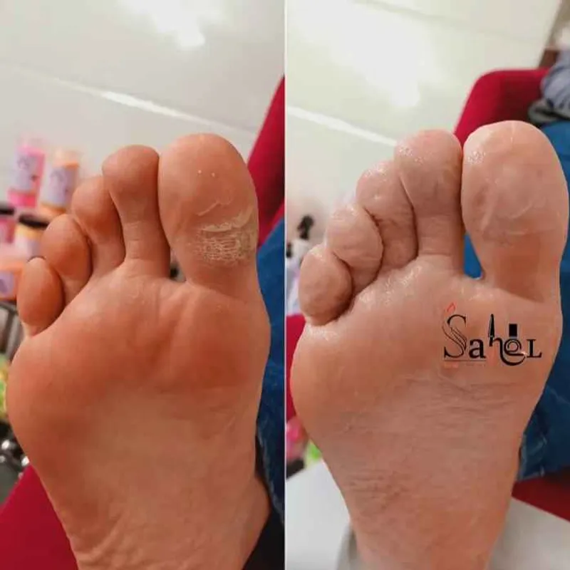 پدیکور کفسابی پا