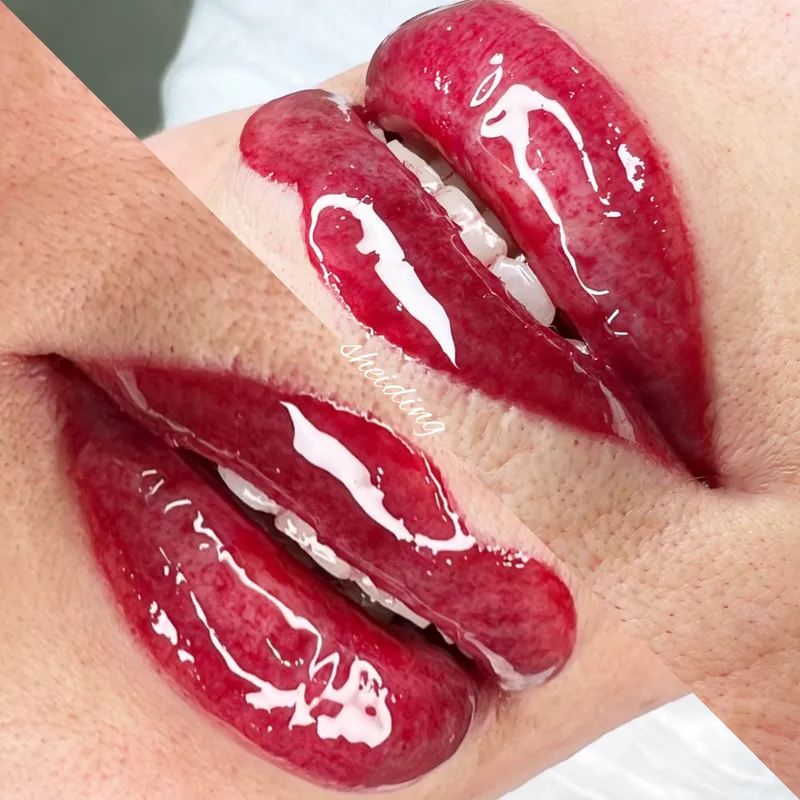 میکرو بلیدینگ ارایش دائم