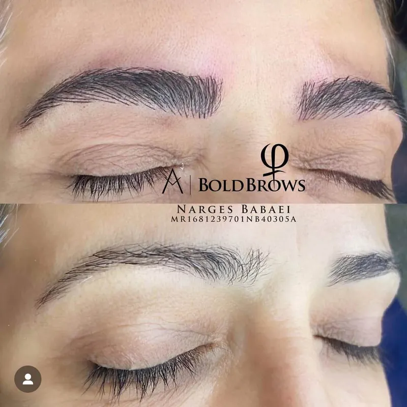 میکروبلیدینگ ابرو