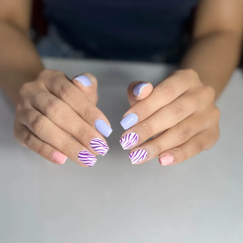 ترمیم پلی ژل و طراحی