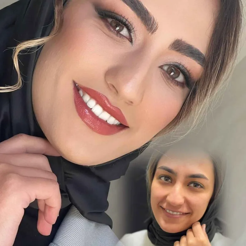 ارائه خدمات زیبایی