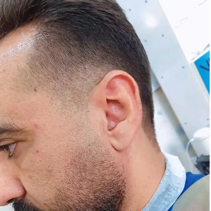 فید ریش و مو 