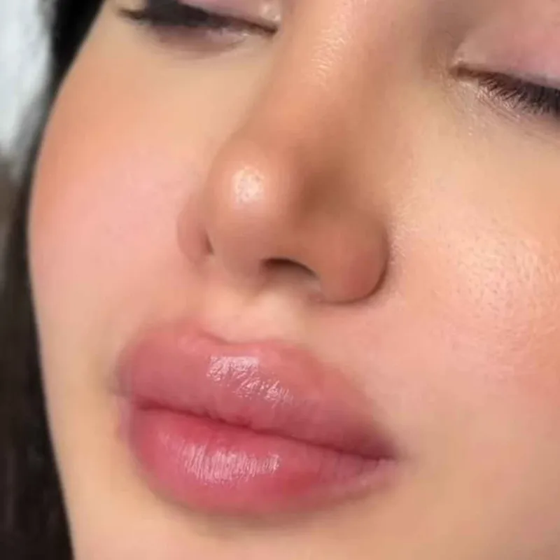 شیدلب . تینت .