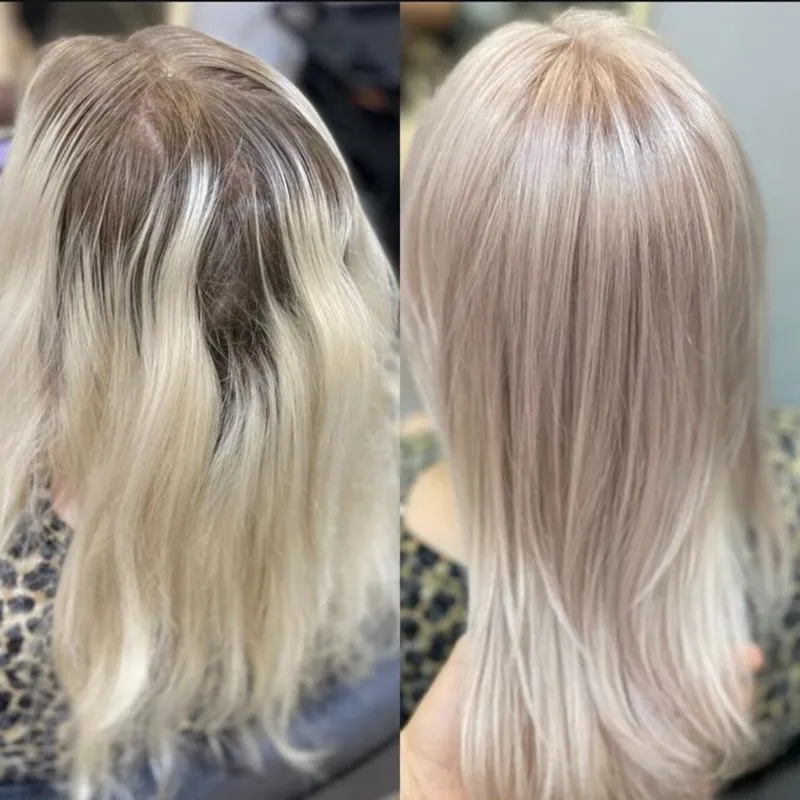 ترمیمی تمام دکلره 