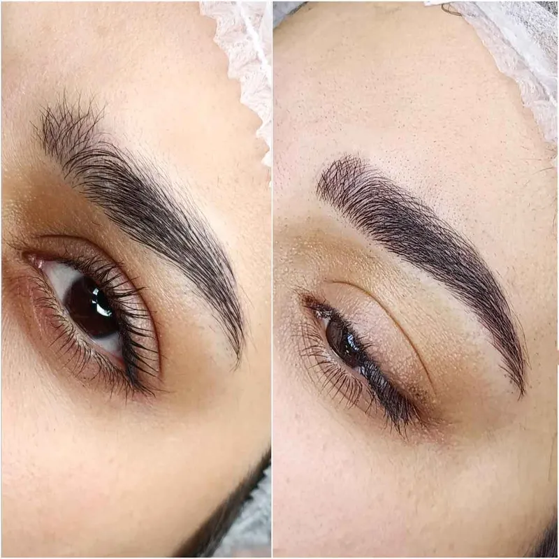 فیبروز ابرو 