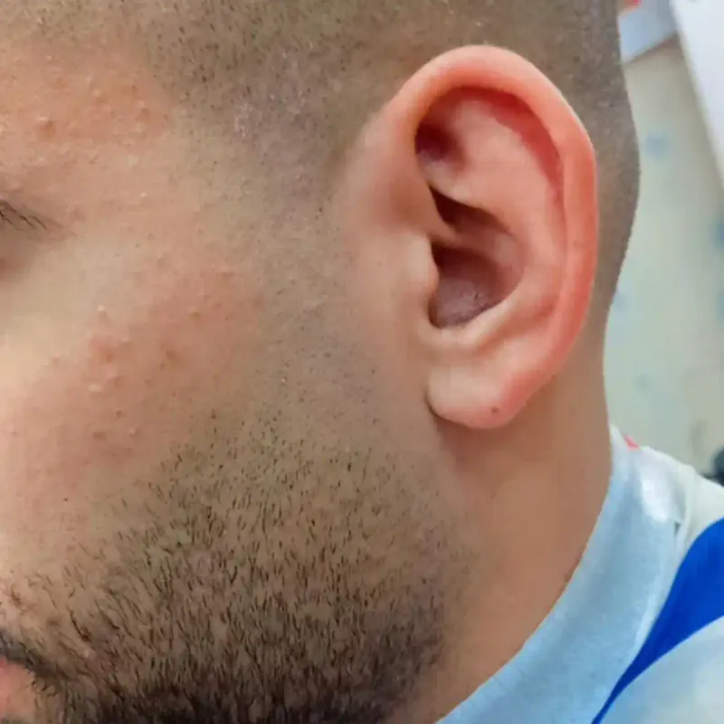 فید،ریش،و فید مو