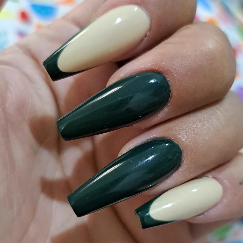 کاشت ژل با قالب