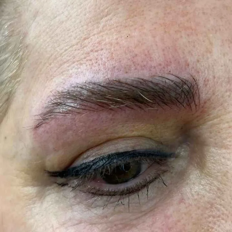 میکرو بلیدینگ