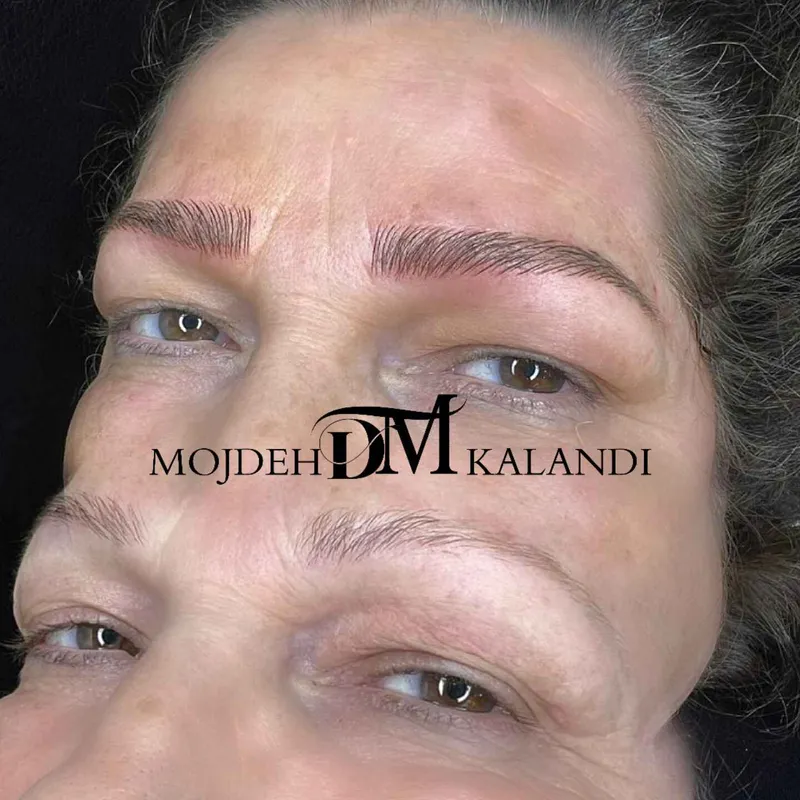 خدمات میکروبلیدینگ و میکروپیگمنتیشن