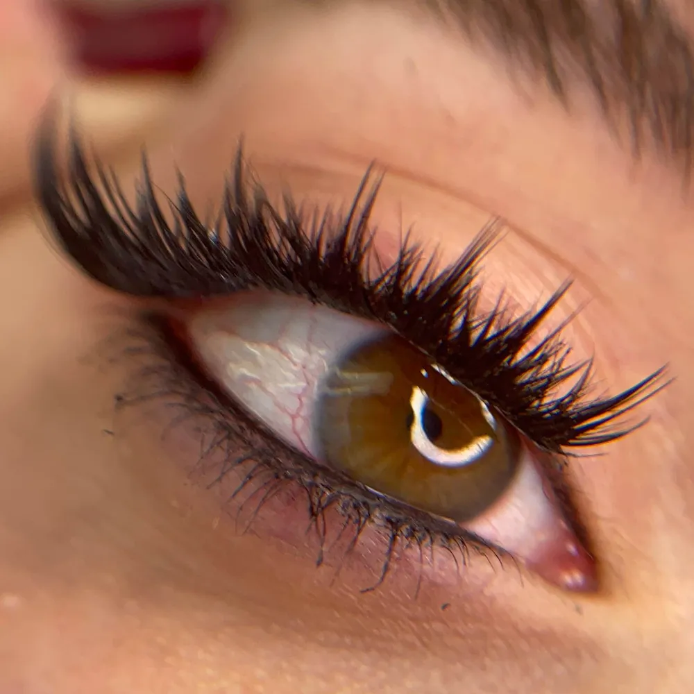 کاشت موقت کایلی