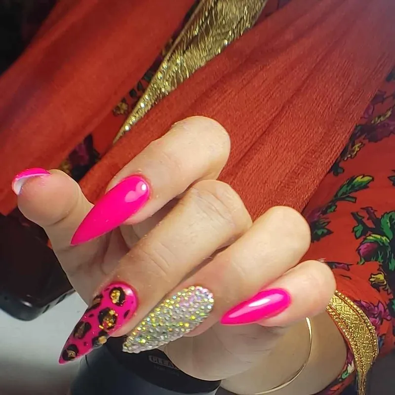 کاشت پایه، مدل تیز و بلند 