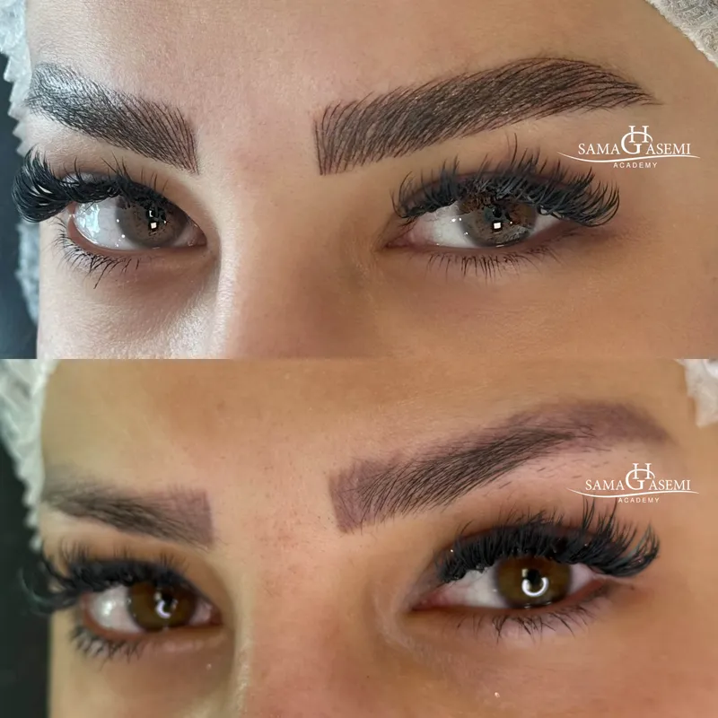 کاور تتوقدیمی ، لاین استروک و میکروبلیدینگ