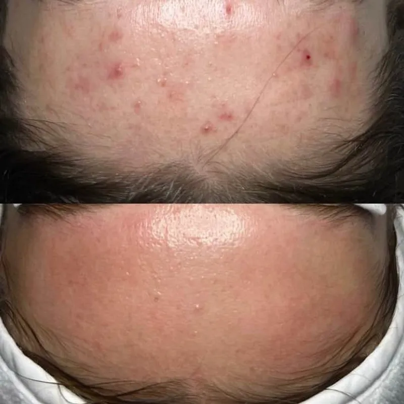 فیشال تخصصی پوست