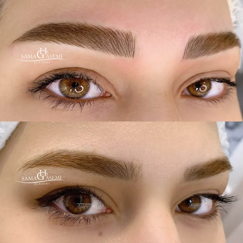 فیبروز ، میکروبلیدینگ کرکی مویی نچرال 