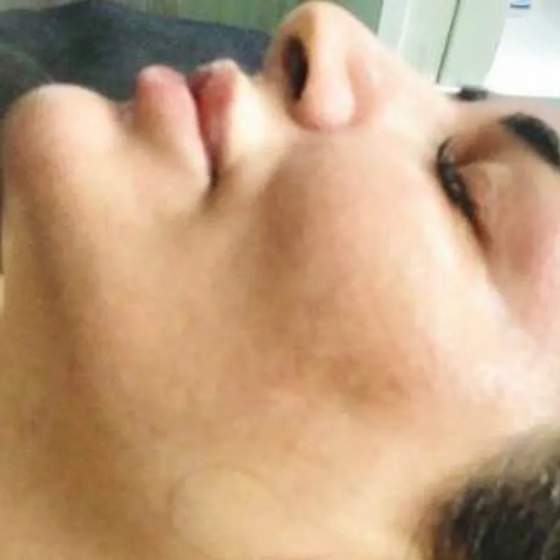 فشیال VIPبه همراه ماساژ تخصصی و فرم دهی صورت 