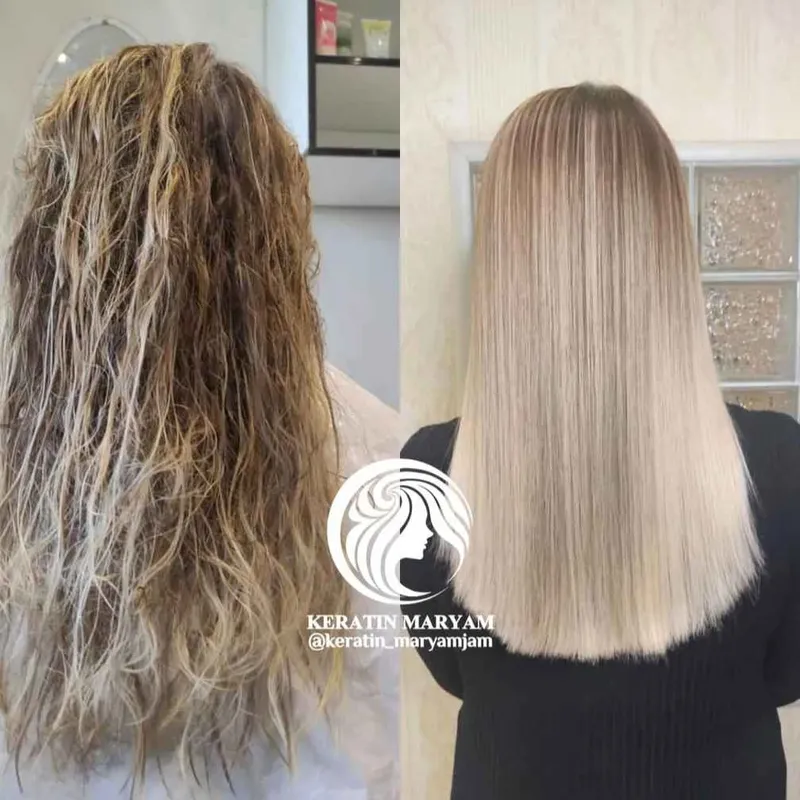 آرژنین تراپی 