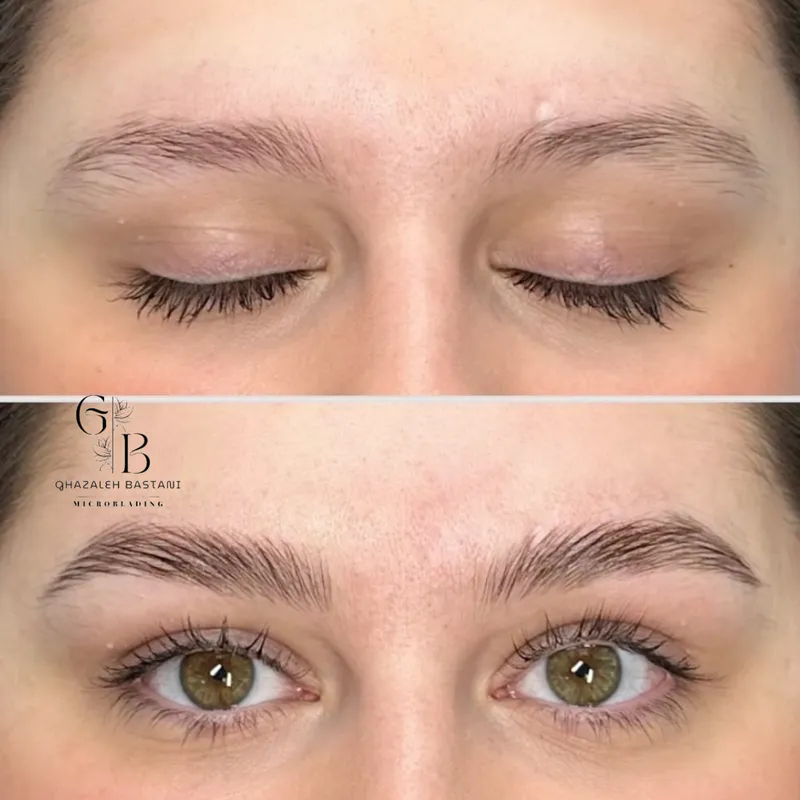 تكنيك موربروز 