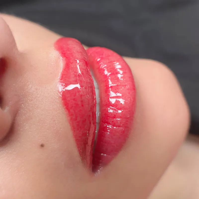 میکروبلیدینگ و میکروپیگمنتیشن